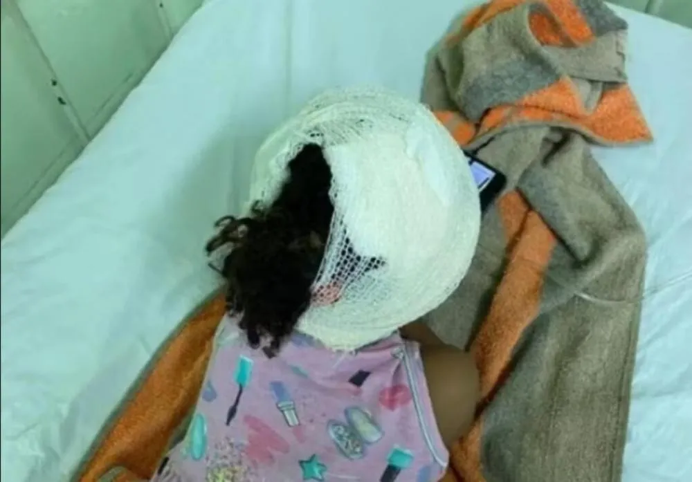 Menina de 3 anos fica ferida após ataque de pitbull na calçada de casa em Oeiras
