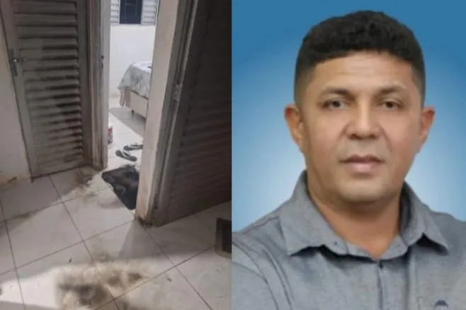 Vereador de Coivaras recebe alta quase três meses após ter corpo incendiado