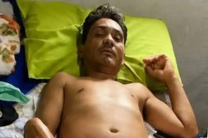 Homem de Santana do Piauí fica gravemente ferido após acidente e família pede ajuda para custear tratamento