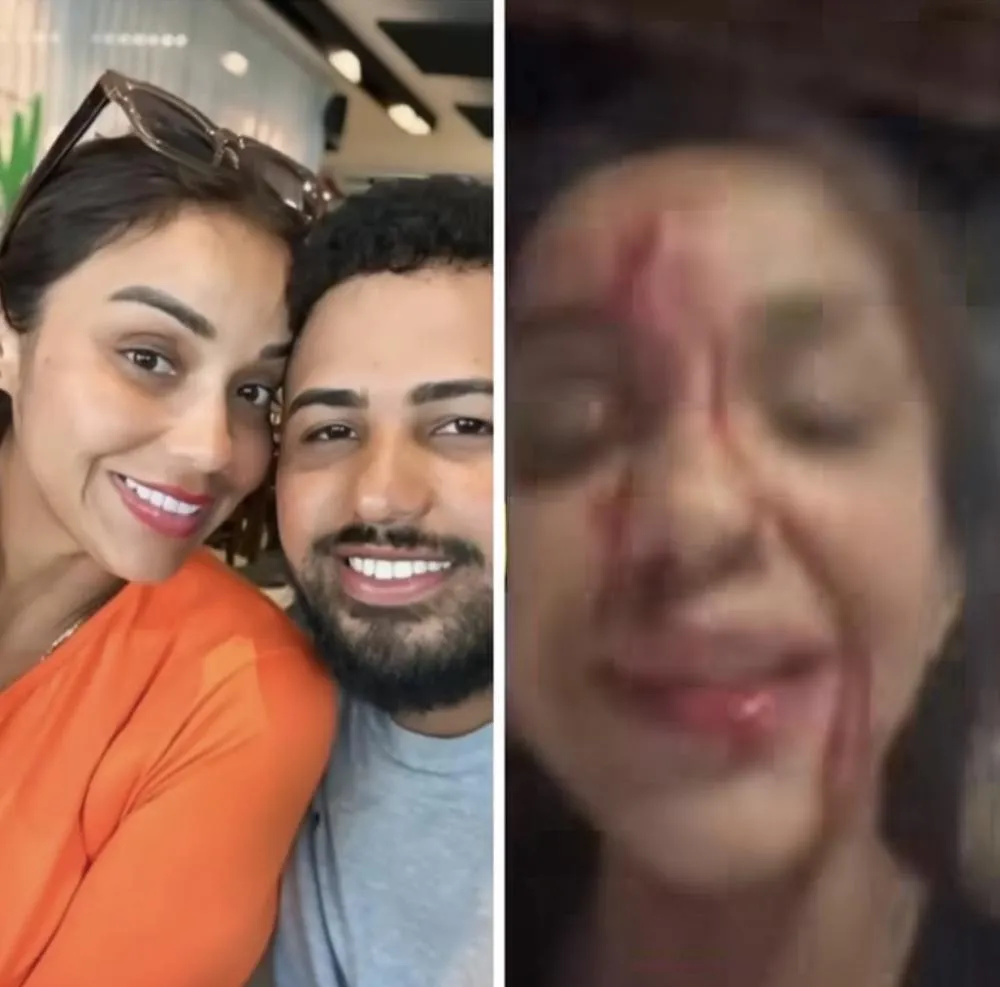 Cantora da Farra da Gordinha aparece ensanguentada durante live em Teresina e relata perseguição do ex-marido