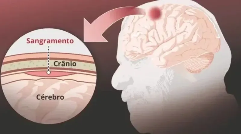 Foto / Reprodução