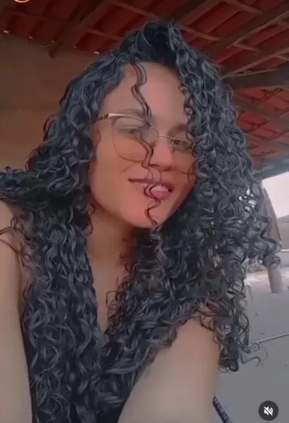 Acidente grave na BR-230 em Oeiras deixa jovem com fratura exposta